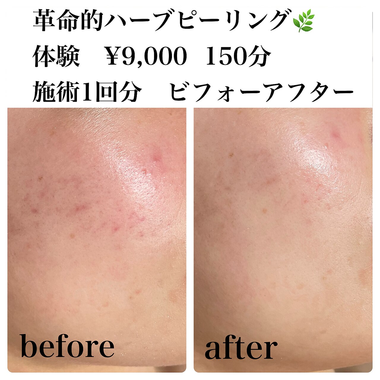ケアオプション（ワンカラー）